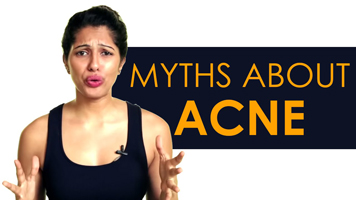 Myths and Facts About Acne